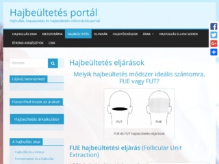 Hajbeültetés kisokos